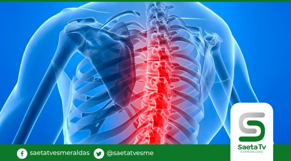 La atrofia muscular espinal es una enfermedad genética