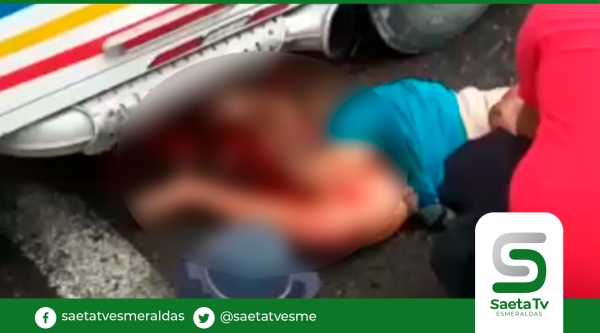 Adulta mayor pierde una de sus piernas en accidente de tránsito